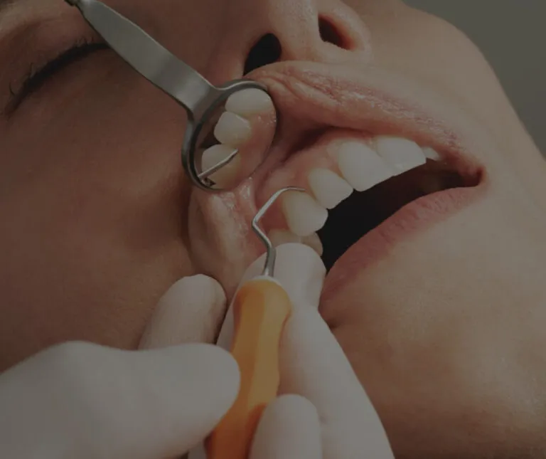 Periodontal Treatment