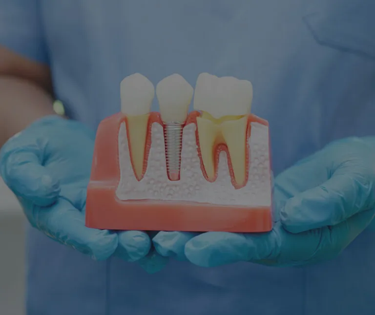 A dentist holding out an example of dental implants