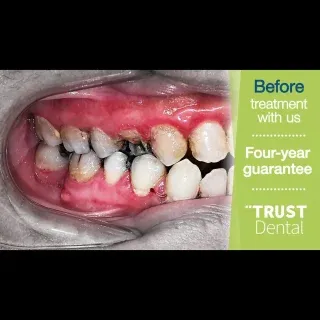Another incredible transformation today 🦷