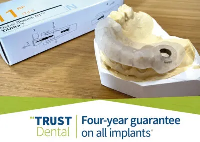 Four-Year Guarantee on All Implants