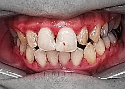 Before cosmetic dentistry treatments at TRUST dental