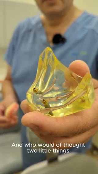 Do Implant retained dentures make a difference?