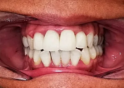 After cosmetic dentistry treatments at TRUST dental