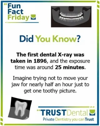 🦷 FUN FACT FRIDAY Is here!!!!!!!! Have the best weekend from all of us at TRUSTDental. 🍾🎉