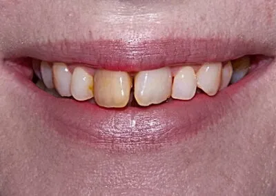 Before cosmetic dentistry treatments at TRUST dental