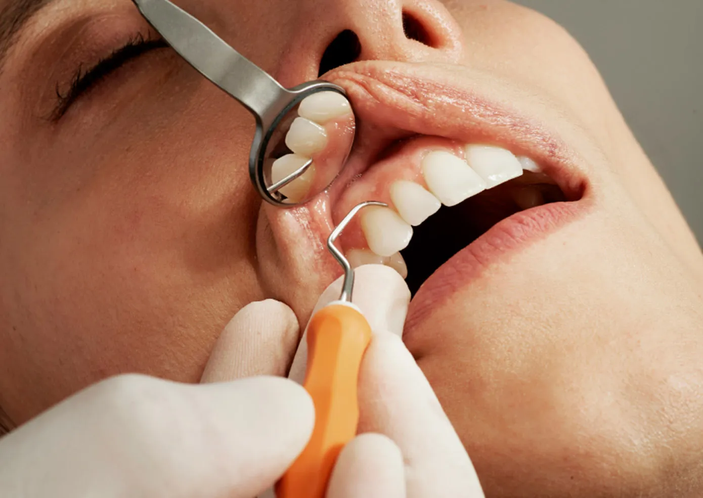 Close up of a dentist working on someones gums and teeth 