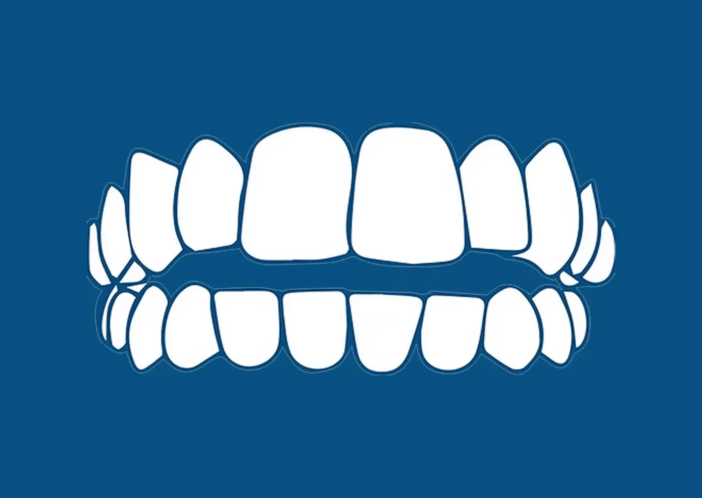 Trust dental before and after teeth whitening